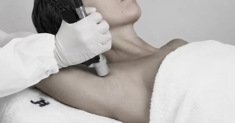 Rutina de beauty pentru sezonul rece: când începi epilarea cu laser și cum te pregătești