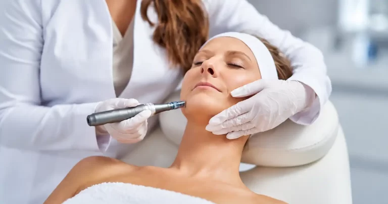 Microneedling la domiciliu: cum funcționează și ce beneficii reale are